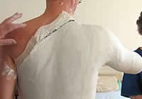 Plâtres circulaires